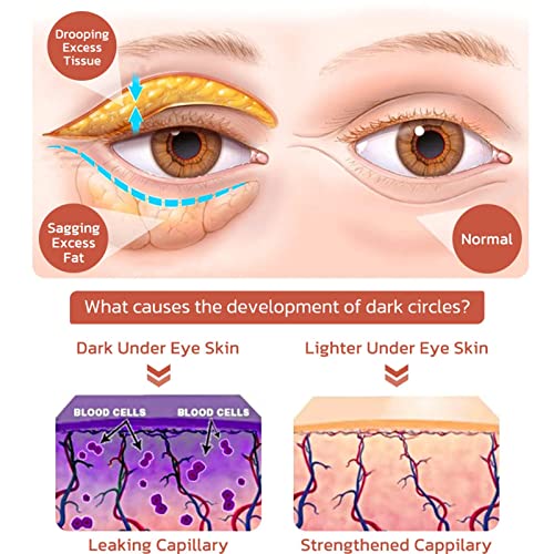 Flysmus caffeineeyes תיקון והרמת קרם עיניים, קרם עיניים ממוקם זמני, עיגולים כהים תחת סרום לטיפול בעיניים, מתאים לכל העור
